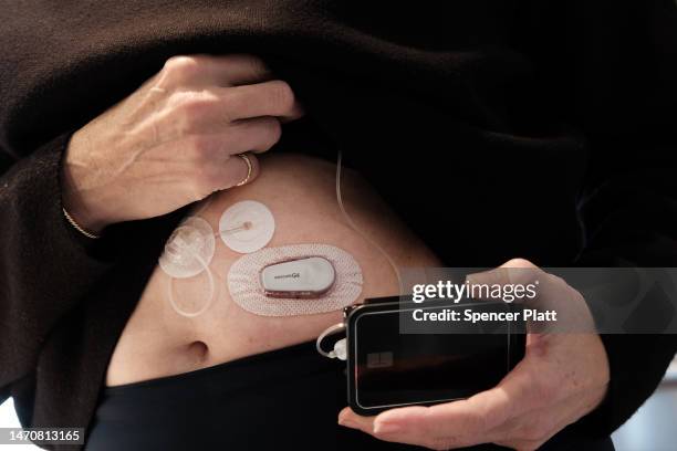 Elizabeth Snouffer, whose had type 1 diabetes for most of her life, displays a pump monitor she uses in conjunction with her insulin on March 02,...