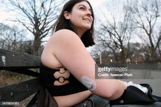 Taylor Jane Stimmler, whose had type 1 diabetes since she was a teenager, displays her continuous glucose monitor she wears on her arm on March 02,...