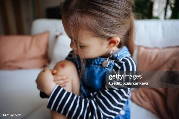 piedi del bambino con ferite e graffi. bambino con ginocchia ferite e ferite su sfondo grigio. - male surprised foto e immagini stock