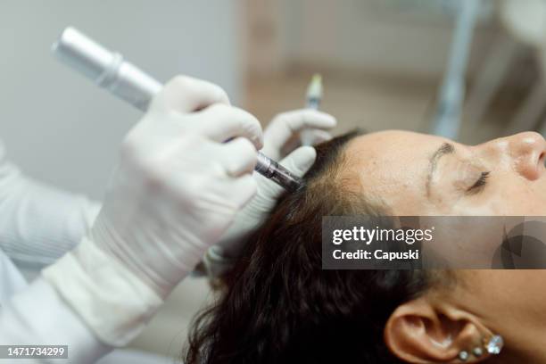 woman having a microneedling procedure done on her hairline - beauty treatment stock pictures, royalty-free photos & images