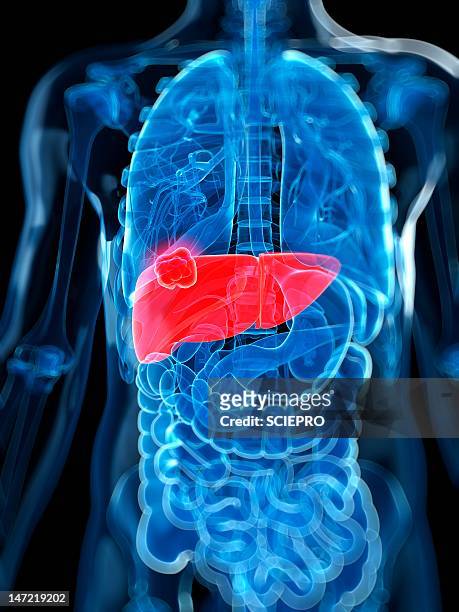 liver cancer, artwork - liver stock illustrations