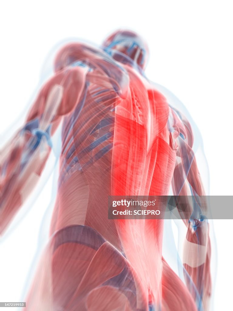 Back pain, conceptual artwork