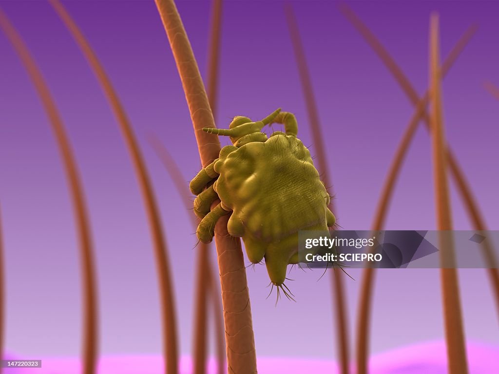 Pubic louse, artwork