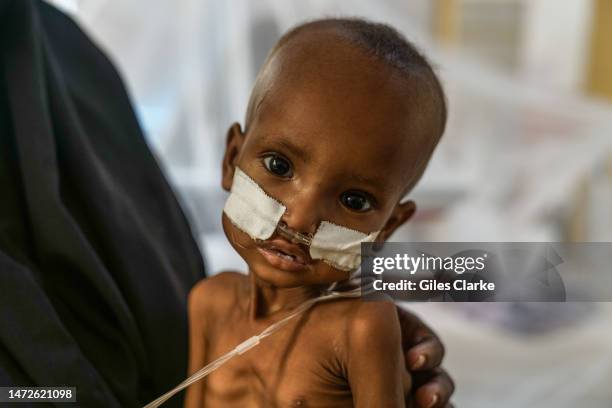 Two-year-old Asma lies in the severe acute malnutrition ward at the Baidoa Regional Hospital on October 25,2022 in Baidoa, Somalia. The current...