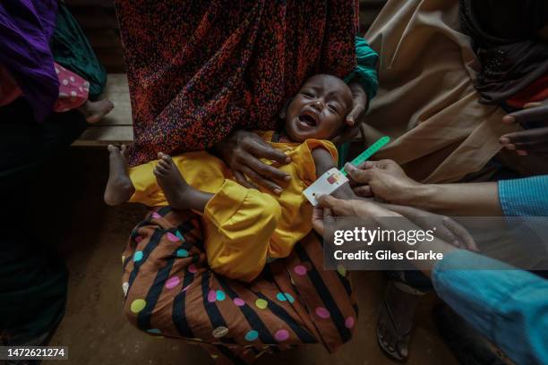 Child is treated at the Outpatient Therapeutic Program area of the UNICEF/USAID supported CEDA hospital health facility on October 16,2022 in Doolow,...