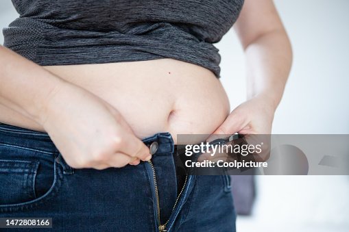 Health - overweight Health - overweight