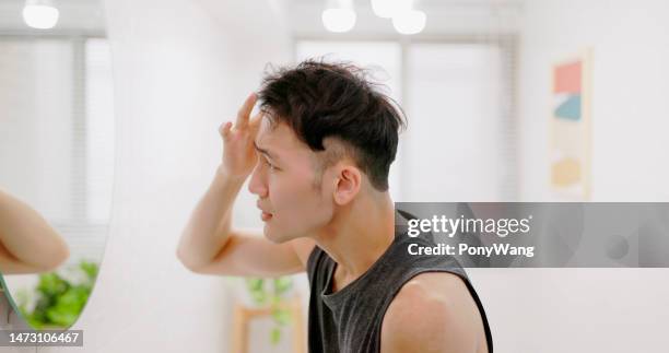 l'uomo si preoccupa della perdita dei capelli - calvizie foto e immagini stock