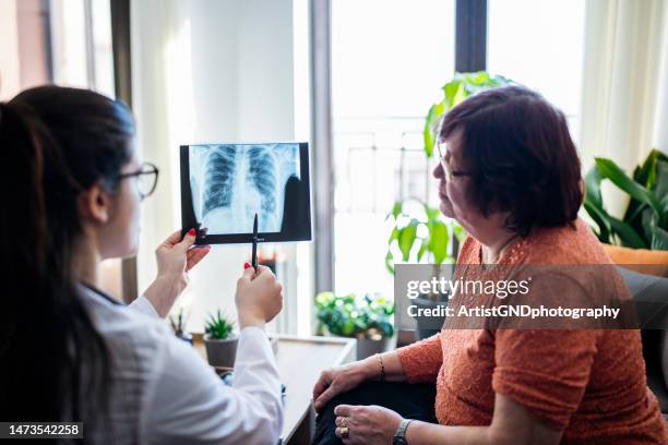 female doctor showing x-ray image to a senior patient at her home. - lunga bildbanksfoton och bilder