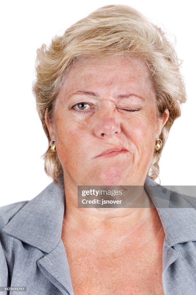 Bell's Palsy - can't scrunch up eyes