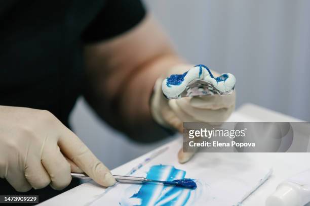 cropped hands female orthodontist working accurately in dental laboratory - crown molding 個照片及圖片檔