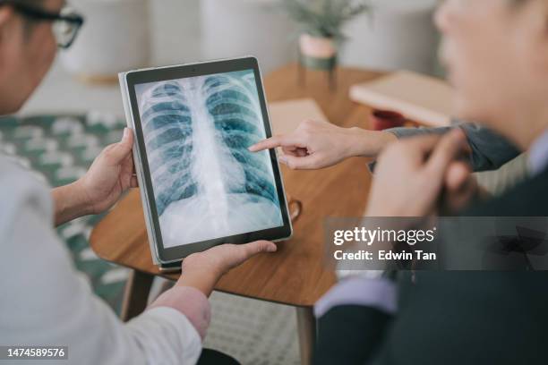 asian doctors looking at xray image on digital tablet discussion in doctor's office - ct scan chest stock pictures, royalty-free photos & images