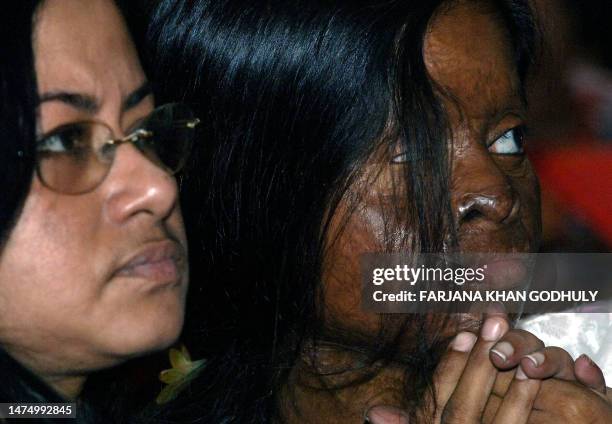 Bangladeshi acid attack victim looks on during the inauguration ceremony of the "Acid Survivors Convention" in Dhaka, 05 November 2007. More than two...