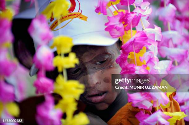 Young Bangladeshi acid attack survivor attends a rally to mark the tenth anniversary of the Acid Survivors Foundation in Dhaka on May 12, 2009. Acid...