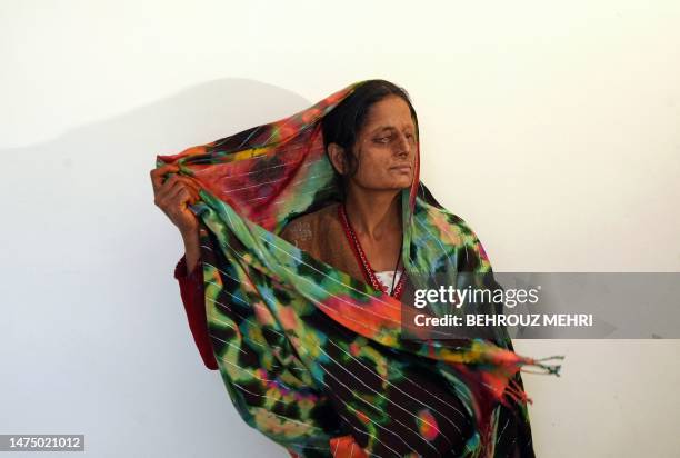 Pakistani acid attack survivor Haleema Bibi adjusts her scarf as she poses for a photograph at the Acid Survivors Foundation in Islamabad on January...