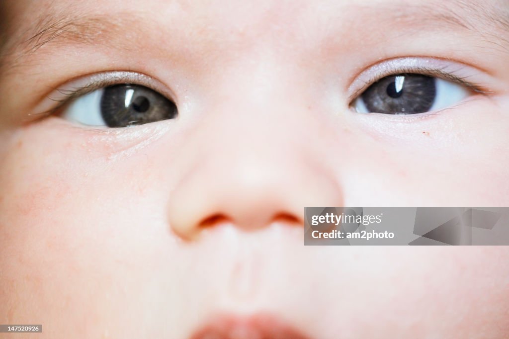 Cross eyed baby