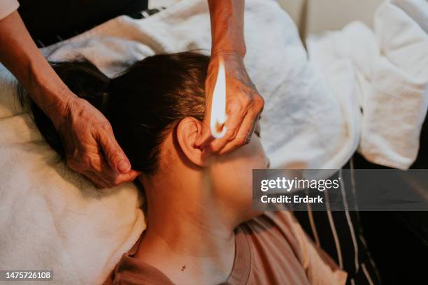 terapia china con vela del oído. - terapia de cera para los oídos fotografías e imágenes de stock