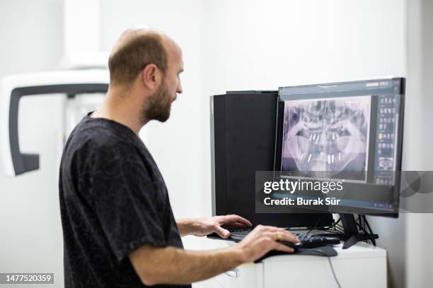 doctor examining x-ray, oral and dental diseases, dentist, dental health, implant treatment - implante imagens e fotografias de stock