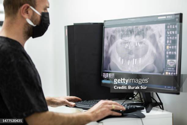 médico examinando raios-x, doenças bucais e dentárias, dentista, saúde bucal, tratamento de implantes - implante dentário - fotografias e filmes do acervo