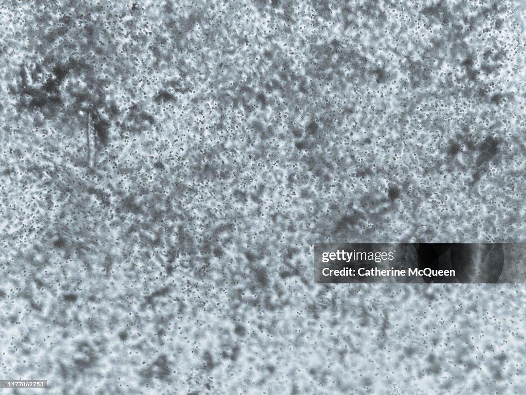 Paramecium organisms under microscope