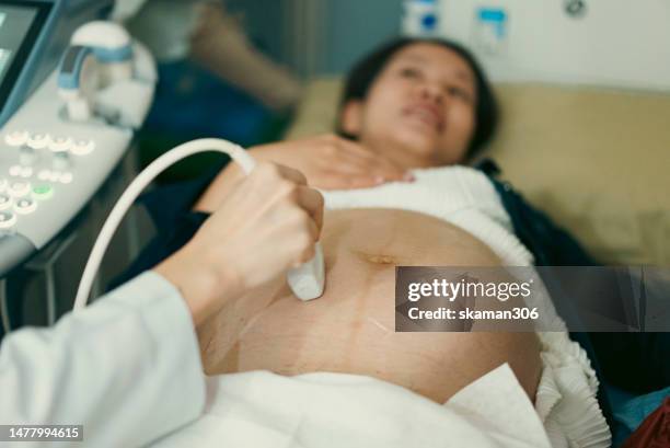 doctor used an ultrasound sonogram  monitor for  the fetus 37 weeks young adult patient pregnant - twin ultrasound stock pictures, royalty-free photos & images