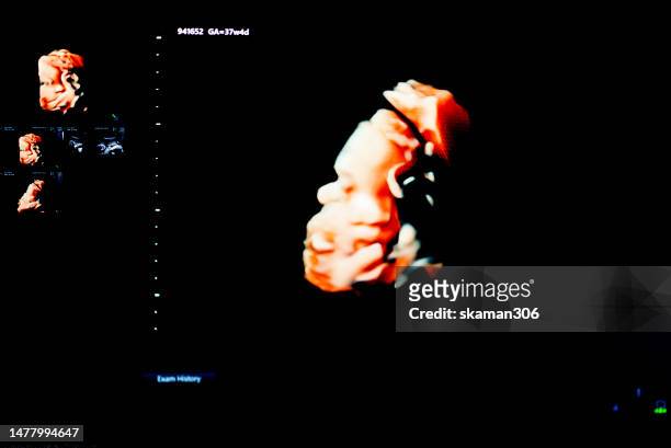 ultrasound sonogram  monitor for  the fetus 37 weeks young adult patient pregnant - 20 week foetus stock pictures, royalty-free photos & images