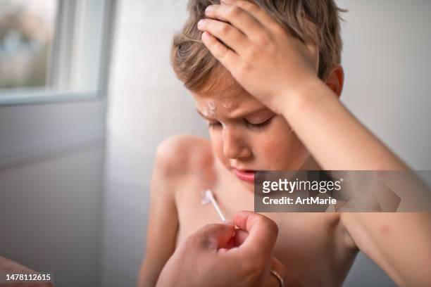 father applies antiseptic medicine against chickenpox to his little boy at home - broeden stockfoto's en -beelden
