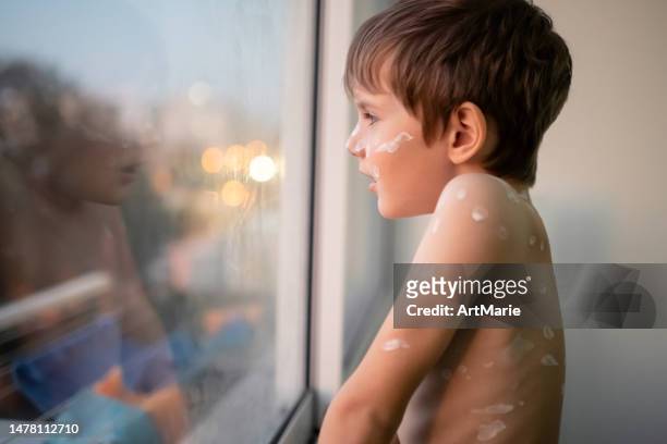 little boy with chickenpox looking through window at home - varicella zoster virus stock pictures, royalty-free photos & images