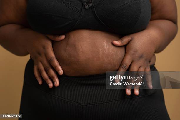 hands of plus size woman touching belly with stretch marks against beige background - human build imagens e fotografias de stock