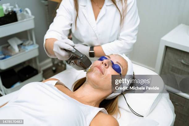 woman getting real laser treatment - laser face stock pictures, royalty-free photos & images