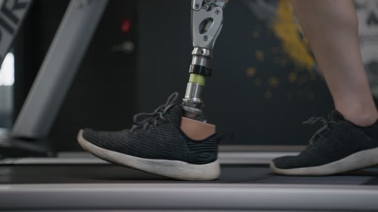Disable Leg Woman Prosthetic Limb Videos and HD Footage - Getty Images