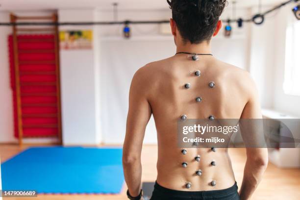 working with patient in modern scoliosis clinic from analysis to exercise - scoliosis stock pictures, royalty-free photos & images