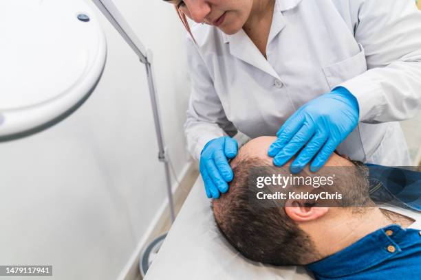 female doctor specialist in baldness checking a patient with hair loss - dermatologist stock pictures, royalty-free photos & images