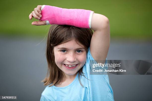 girl proud of her broken wrist shows off her cast - kind gips stock-fotos und bilder