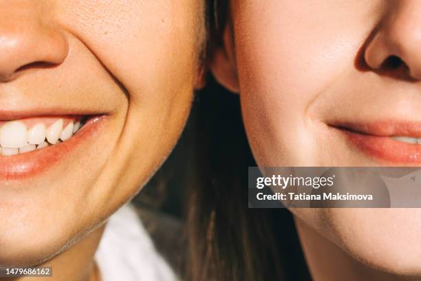 two young beautiful smiling women close-up. part of faces. diversity concept. - tooth bonding stock pictures, royalty-free photos & images