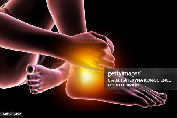 man with ankle pain, illustration - ankle sprain stock illustrations