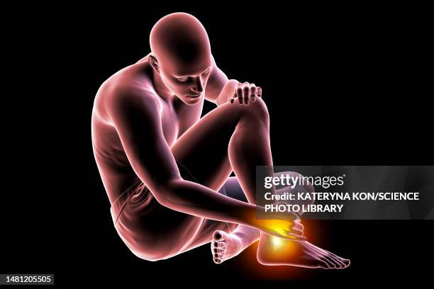 man with ankle pain, illustration - ankle sprain stock illustrations