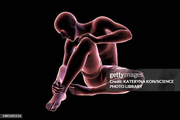 man with ankle pain, illustration - ankle sprain stock illustrations