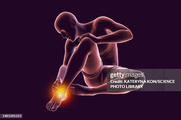 man with ankle pain, illustration - ankle sprain stock illustrations