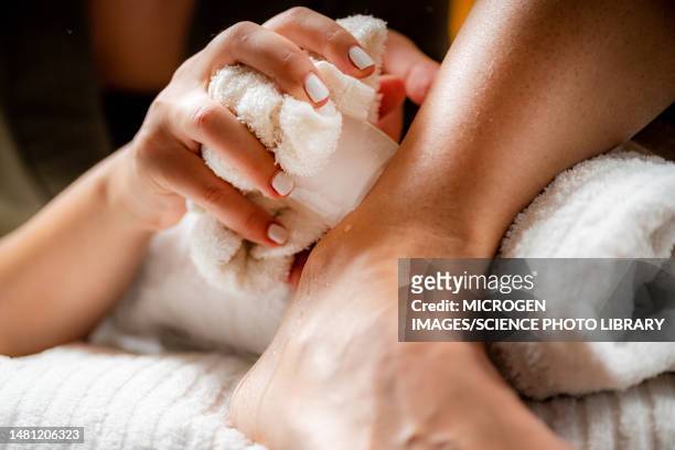 ankle injury ice massage - swollen ankles 個照片及圖片檔