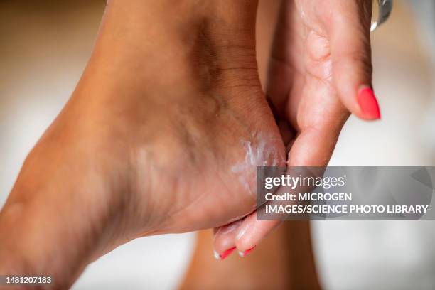 woman applying heel treatment cream - human foot stock pictures, royalty-free photos & images