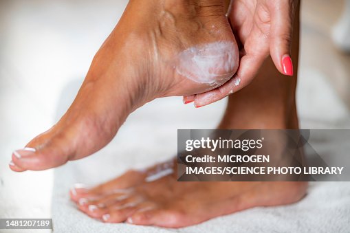 Foot mask treatment Foot mask treatment