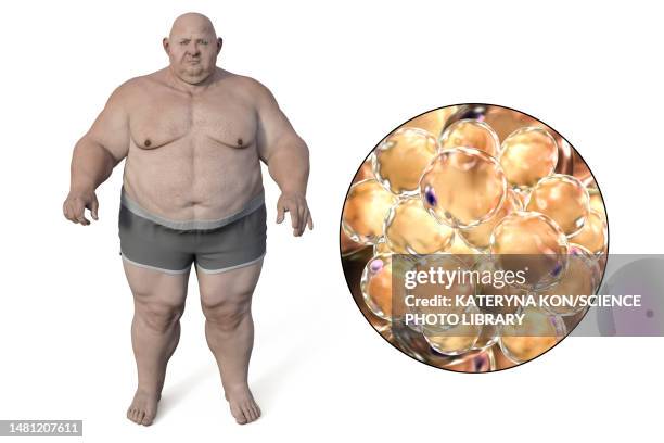 ilustraciones, imágenes clip art, dibujos animados e iconos de stock de obese man and fat cells, illustration - tejido adiposo