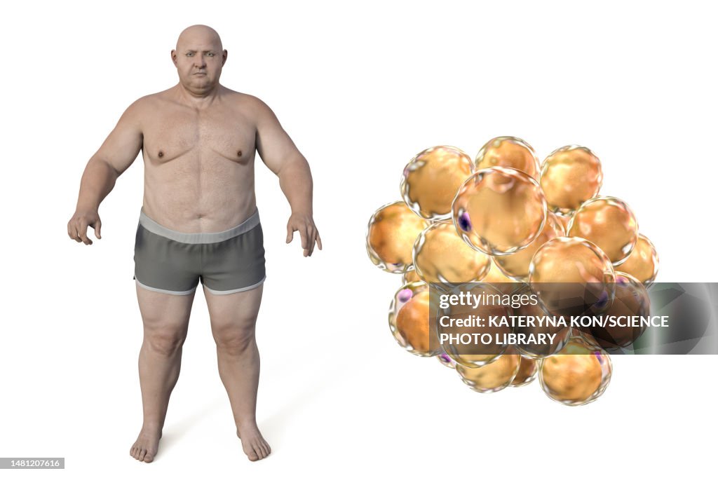 Obese man and fat cells, illustration