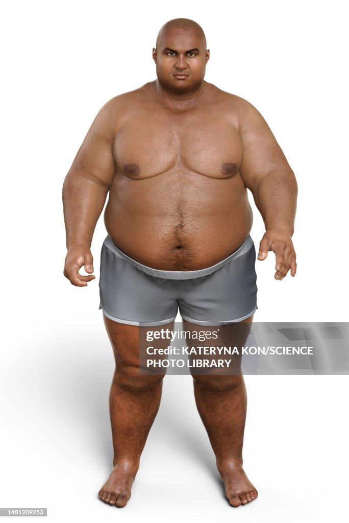 Obese man standing, illustration