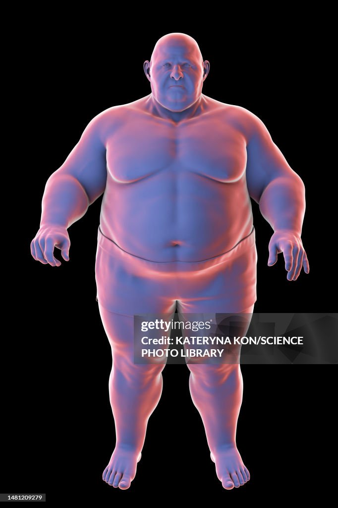 Obese man standing, illustration