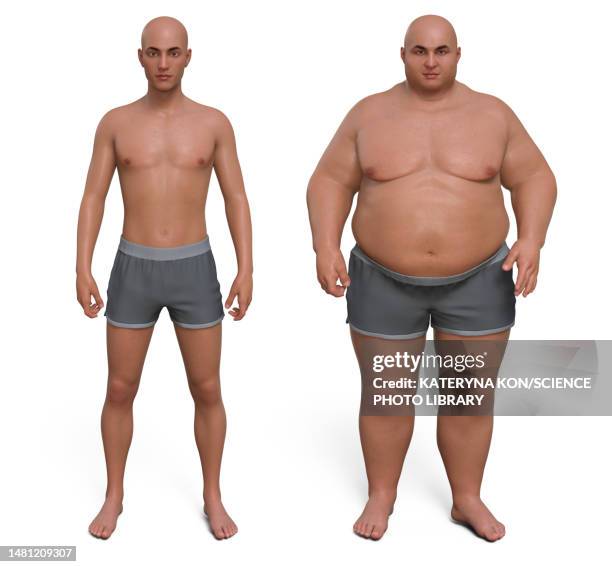 man before and after gaining weight, illustration - binge eating disorder stock illustrations