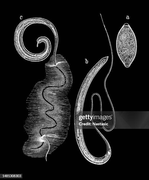 illustrazioni stock, clip art, cartoni animati e icone di tendenza di trichuris trichiura, trichocephalus trichiuris o tricocefali, è un nematode parassita - infezione parassitaria