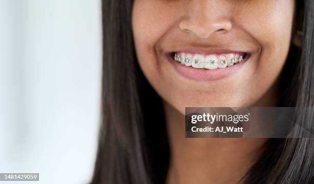 primo piano di una giovane donna sorridente con l'apparecchio dei denti - apparecchio ortodontico foto e immagini stock