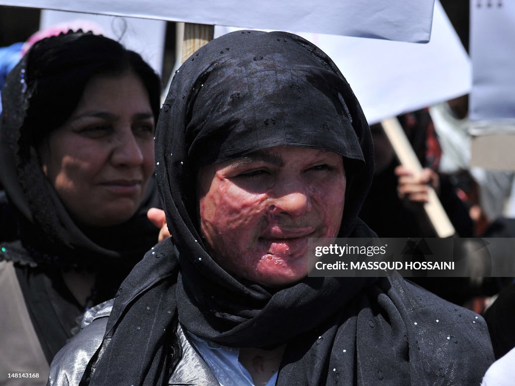 TOPSHOT-AFGHANISTAN-UNREST-TALIBAN-WOMEN-RIGHTS