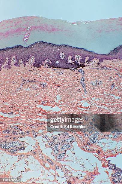 skin, human--epidermis, dermis and hypodermis, 25x - lederhuid stockfoto's en -beelden